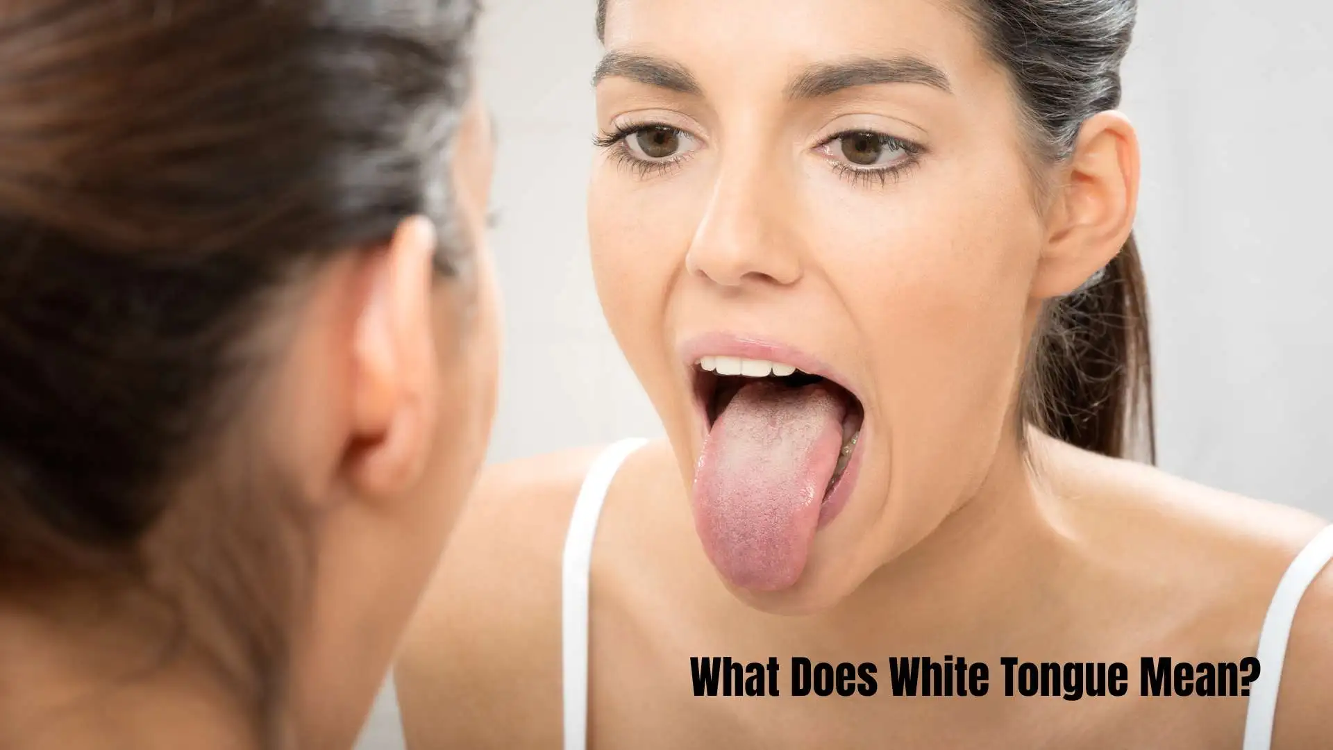 What Does White Tongue Mean? Causes, Symptoms and Treatments Explained for 2026